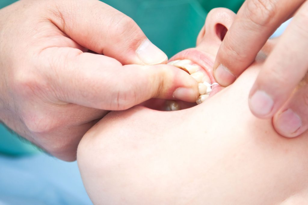 Periodontal Care in Lawrence KS