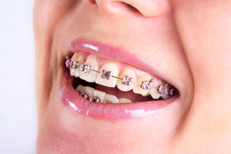 Best Orthodontists In St. Johns