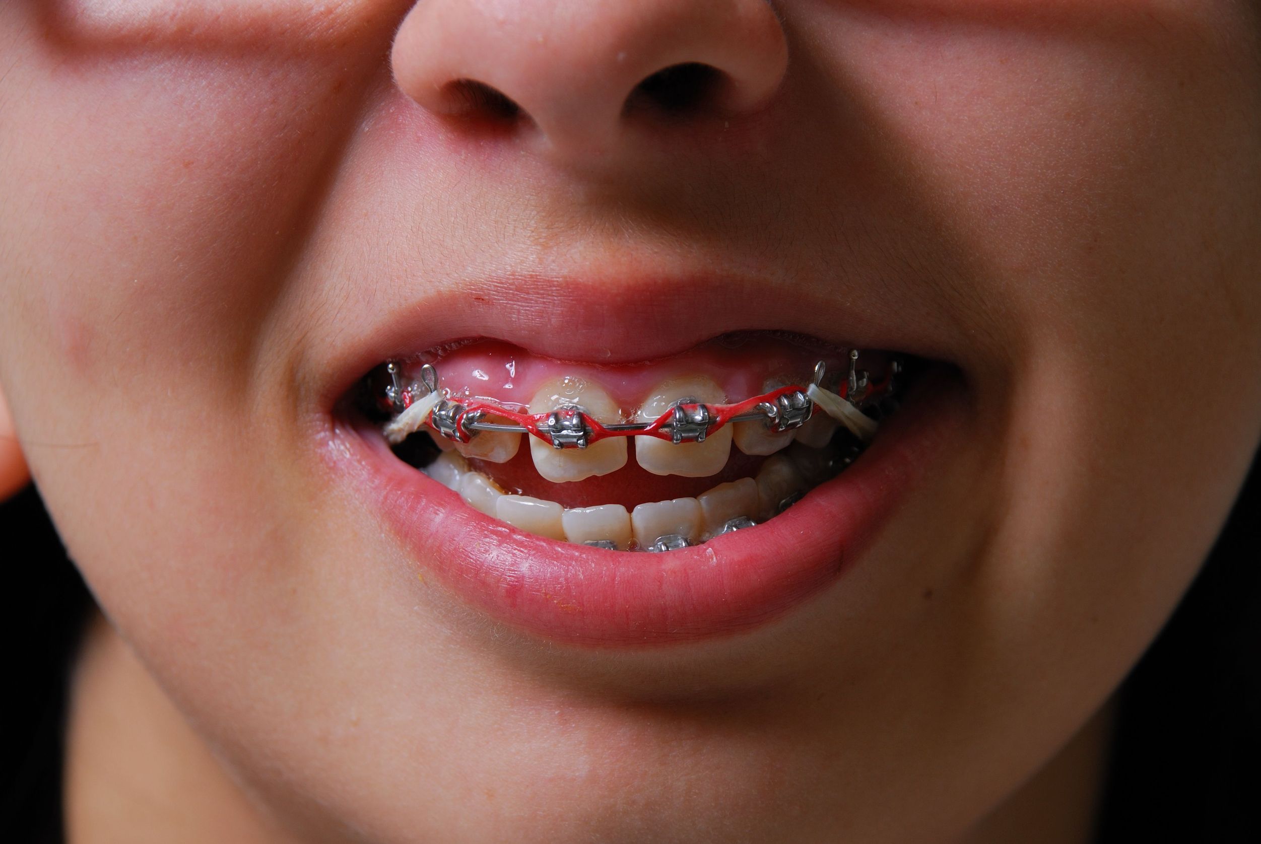 Dentists SEO