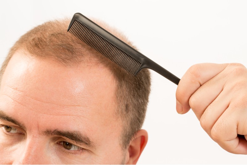 Discover Confidence with Human Wig Store in Salt Lake City by Argyle Hair Solutions.