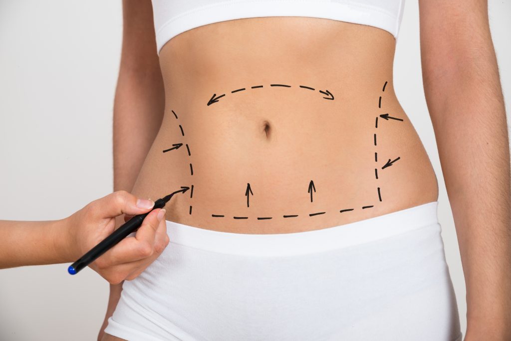 Enhance Your Appearance with Plastic Surgery in Chicago